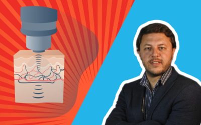 Disfunción Eréctil Tratamiento Ondas de Choque